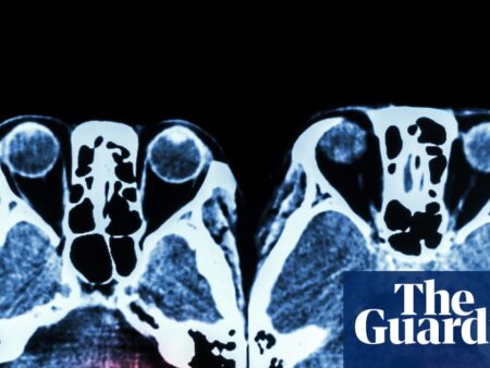 Key stroke treatment still not available around the clock across England