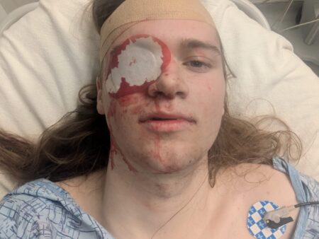 LA teen loses eye after being shot by US agent at No Kings march, lawyer says