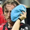 Broken cheekbone but Croatia back Modric recovery for World Cup