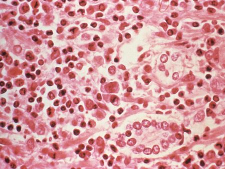 Three dead in suspected hantavirus outbreak on Atlantic cruise ship