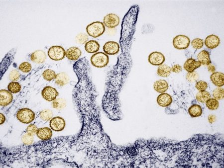 Hantavirus: Where the rare, sometimes deadly disease has been found in the US