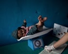 Child malnutrition in Nepal has reached ‘alarming’ levels since aid cuts, survey finds