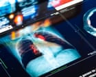 Doctors and NHS could be sued for mistakes made by AI tools, report warns