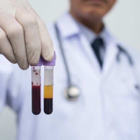 Power of plasma: How to curb new viral outbreaks that lack vaccines