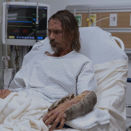 ‘The Pitt’ Makeup Head Unpacks the Show’s Goriest Moments, From a Bloody Head Flap to Tongue Lacerations